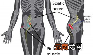梨状肌能自愈吗 还是治疗比较好