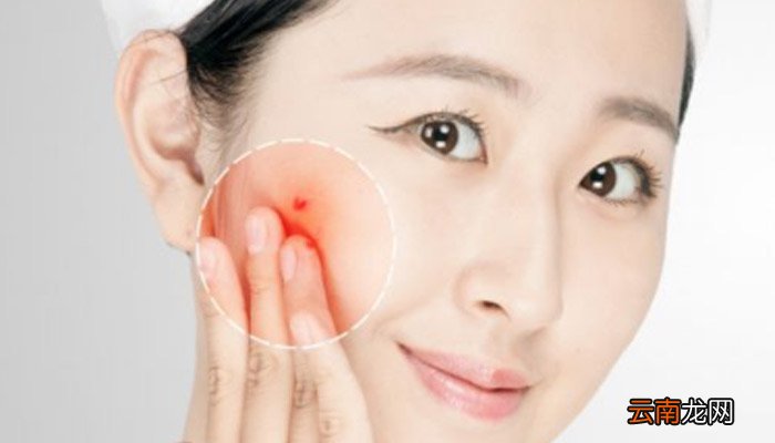 牙膏加醋洗脸的好处牙膏加醋洗脸有什么好处