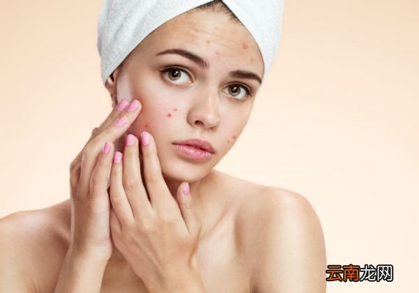 使用芦荟胶需要避免的误区有哪些 使用芦荟胶的误区