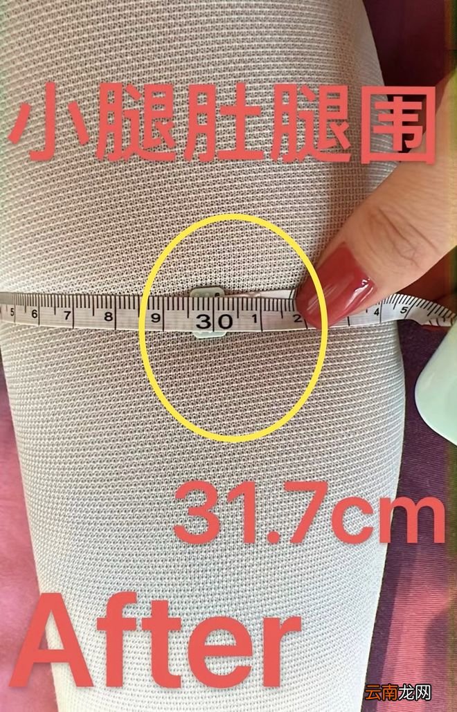 产后552天,我的身材像被轰炸过一样