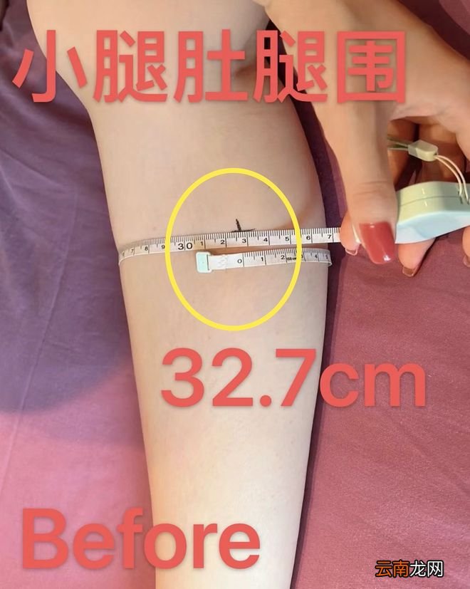 产后552天,我的身材像被轰炸过一样