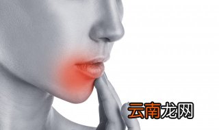 口腔溃疡怎么治才好 最快治口腔溃疡的方法