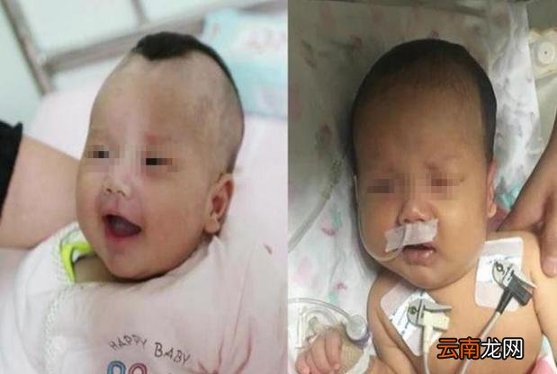宝宝因颅内出血,不幸离开人世,检查结果出来后,妈妈无法接受