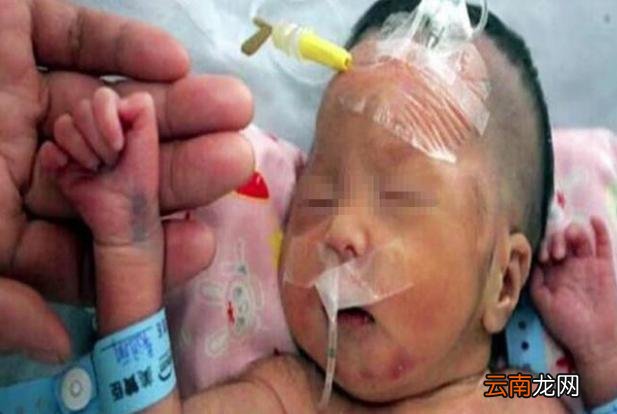 宝宝因颅内出血,不幸离开人世,检查结果出来后,妈妈无法接受