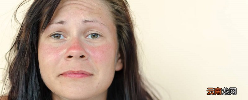 皮肤受伤了怎么修复 如何修复皮肤损伤