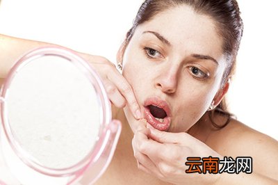 下巴长痘痘怎么办 下巴长痘痘怎么治