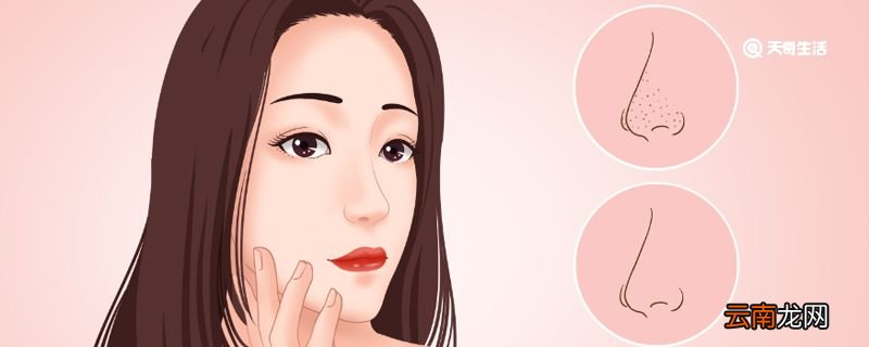 如何去黑头 学生如何去黑头粉刺