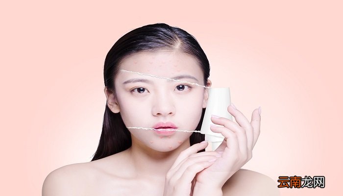 粉刺针祛粉刺的方法 怎么去粉刺