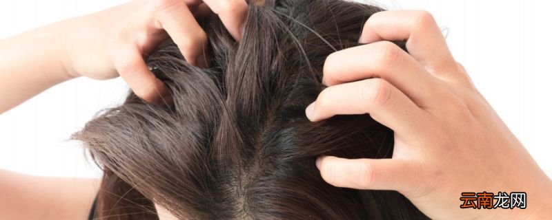 头皮痒怎么办 如何解决头皮痒的问题
