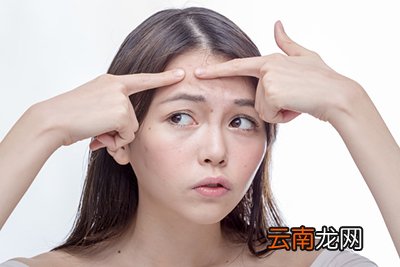 额头长痘是什么原因 额头长痘怎么回事