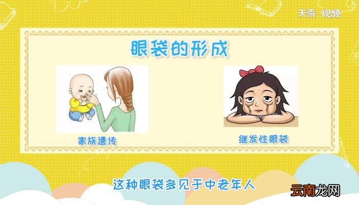 眼袋是怎么形成的 眼袋是什么