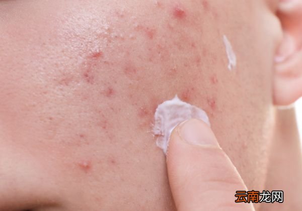 气垫BB用洗面奶可以洗掉吗 洗面奶卸BB霜的影响