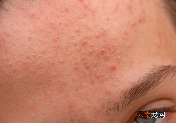 气垫BB用洗面奶可以洗掉吗 洗面奶卸BB霜的影响