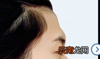 额头被撞凹进去了怎么办 谁知道