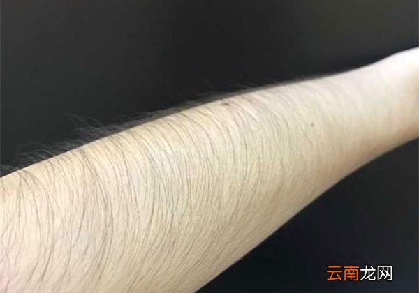 去手毛的永久小窍门 脱手毛小妙招