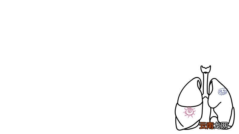 预防新型冠状肺炎手抄报