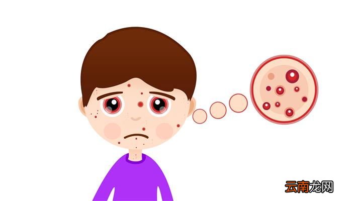 小孩上嘴唇上翘是怎么回事小孩上嘴唇为什么上翘