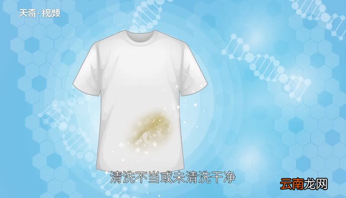 白衣服泛黄怎么办 白衣服穿久了泛黄怎么办