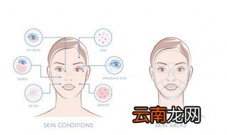 油性皮肤怎么改善 油性皮肤护理的注意事项