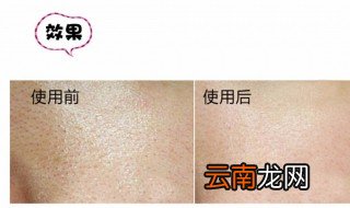 如何缩小毛孔 收缩毛孔这三个办法快收好