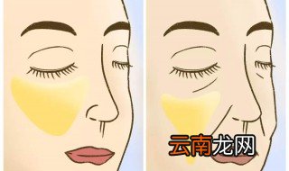 什么是法令纹 法令纹的名字由来
