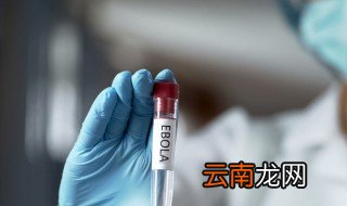 埃博拉如何传播 埃博拉病毒可以通过空气来扩散吗