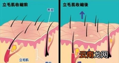 怎样改善因涂了防晒喷雾之后起的鸡皮疙瘩