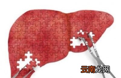 如何早发现肝病定期体检