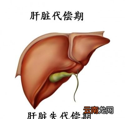 肝病的前期有什么前兆