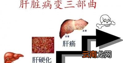 肝病的前期有什么前兆