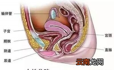 盆腔积液和宫腔积液有什么区别