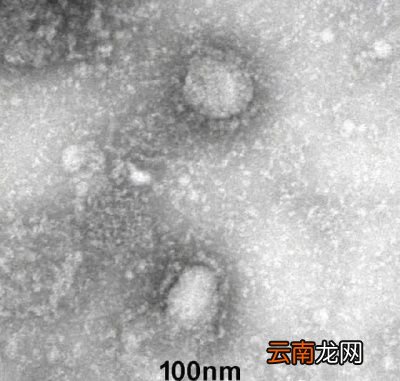 什么是平常感冒药