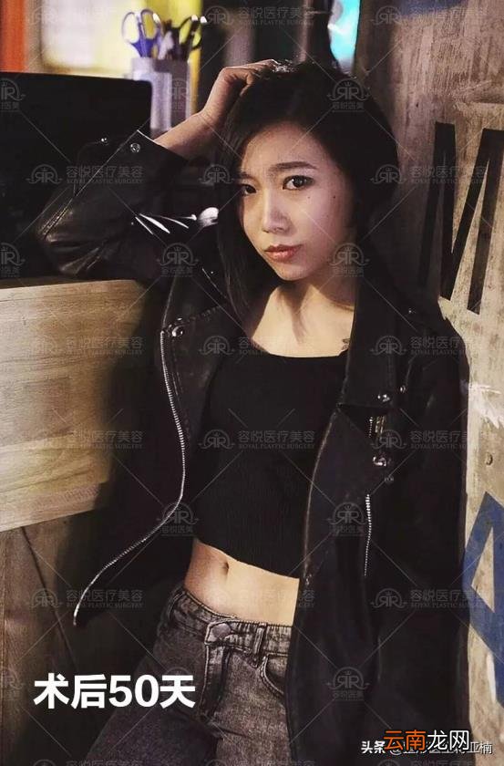 抽脂手术的价位 抽脂得多少钱