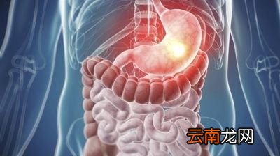 哪些人群不建议多喝酸奶呢