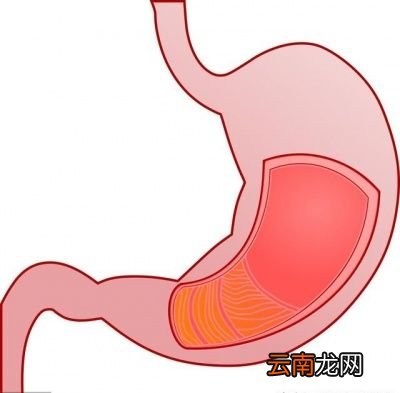 养胃之前先来看看引发胃病的因素有哪些