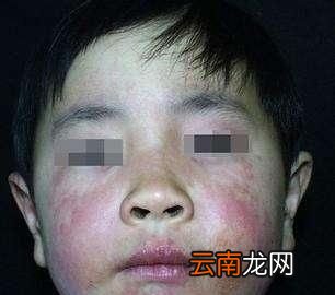 宝宝如何吃芒果