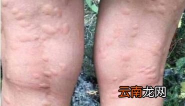 孕妇可以用花露水吗