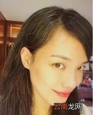 为什么长白头发