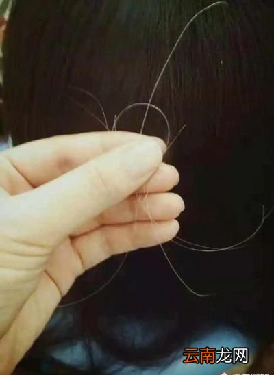 头顶的白发太多有什么方法能变黑发