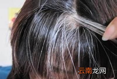 头顶的白发太多有什么方法能变黑发