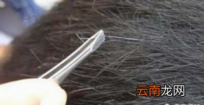 头顶的白发太多有什么方法能变黑发