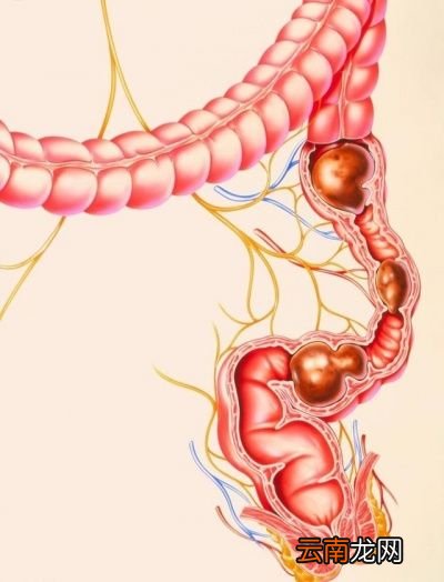正常人一天排几次大便合适