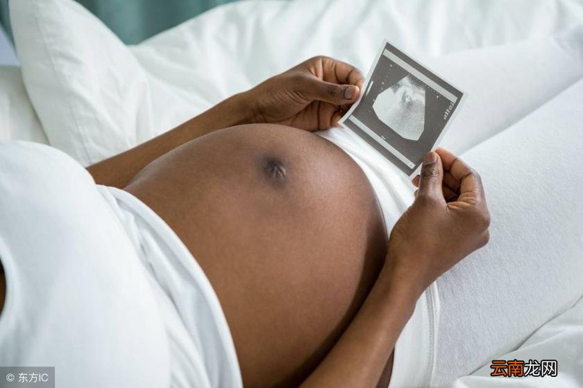 NT三个亮点是男孩女孩 四维彩超多少钱