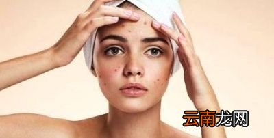 雄性激素分泌过多的原因