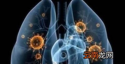 针对冠状病毒肺炎农民需要防范吗