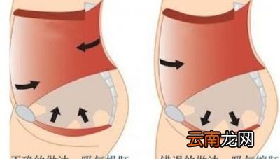 提肛运动怎么做