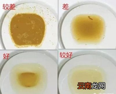 肠镜检查前要做哪些准备