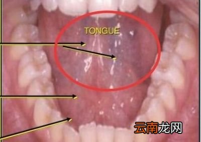青筋发黑什么情况