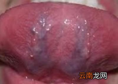 青筋发黑什么情况