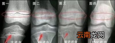 什么样的运动对长高有帮助